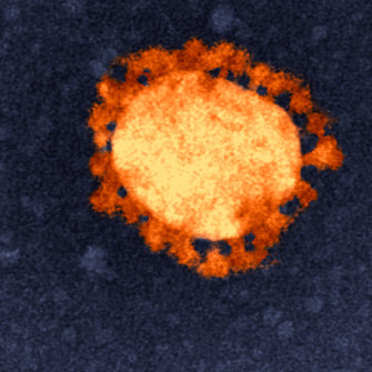 The virus responsible for COVID-19, isolated from the first Australian coronavirus case and captured in this colorised transmission electron micrograph image.