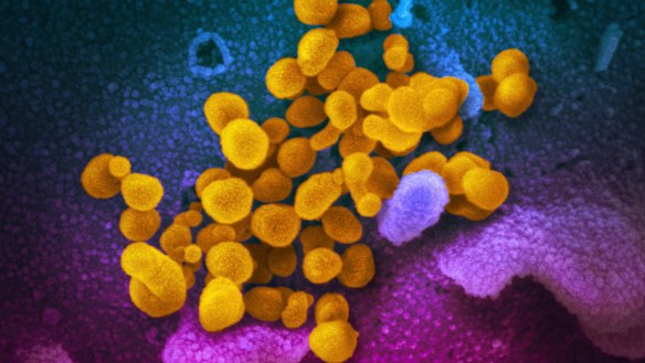 An electron microscope image shows the novel coronavirus SARS-CoV-2.