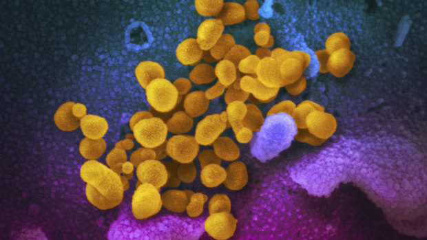 An electron microscope image shows the novel coronavirus SARS-CoV-2.