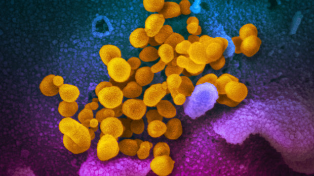 Novel coronavirus (yellow) emerges from the surface of cells in a culture grown from a patient in the United States.  