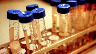 France will allow single women and lesbian couples to seek IVF treatment.