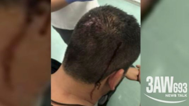 A bleeding passenger after a brawl on the Carnival Legend cruise ship.