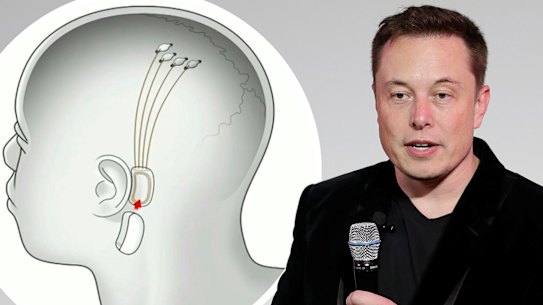 Elon Musk is making big promises about his medical start-up.