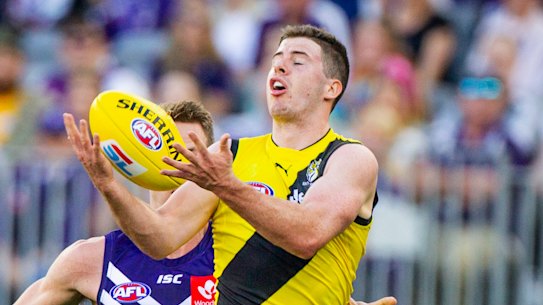 Tiger Jack Higgins is out indefinitely after being diagnosed with a brain bleed.