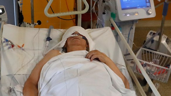 A COVID-19 patient lies on a bed in an intensive care unit.