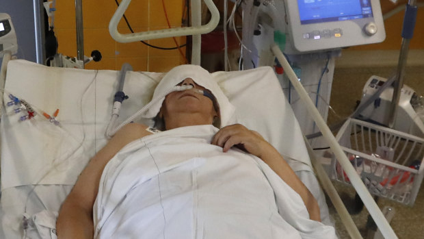 A COVID-19 patient lies on a bed in an intensive care unit.