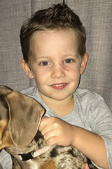 The bite caused traumatic lacerations to Charlie's face, nose, eyelids, forehead and scalp