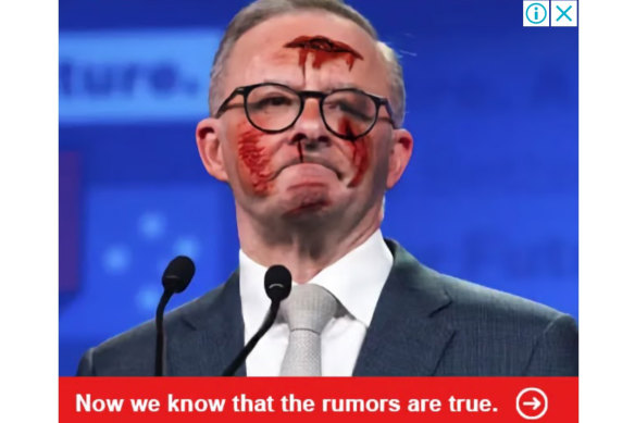 One of the Google scam ads featuring a fake image of Prime Minister Anthony Albanese that ran in late November. 