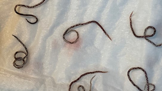 Adult rat lungworms.