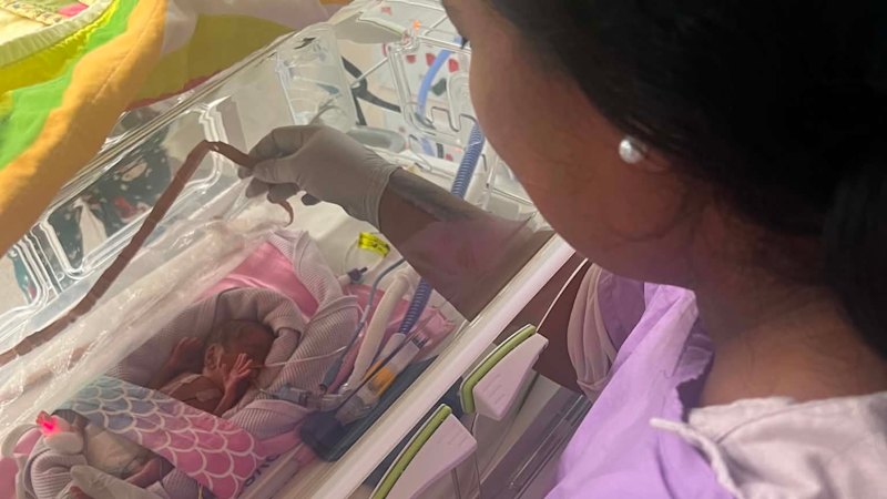 Meet baby Miracle: Australia’s most premature newborn to survive