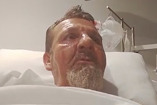 It’s alleged his lighter did not work until he got to the third patient – 54-year-old Randovan Banic.