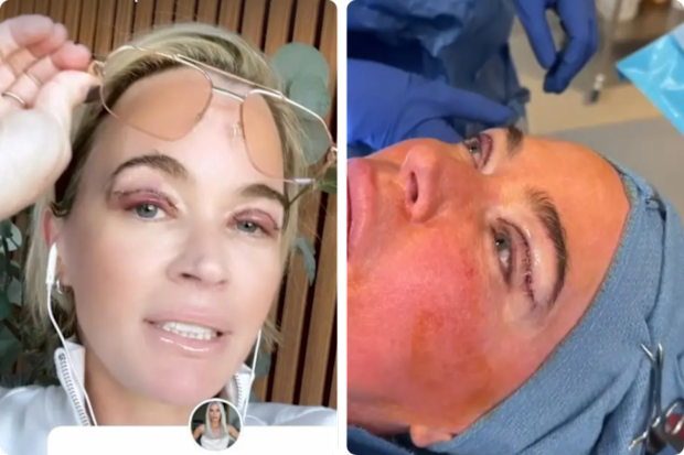 Teddi Mellencamp undergoes plastic surgery while battling stage 4 cancer