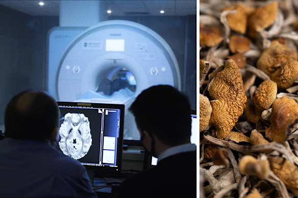 62 people took magic mushrooms inside an MRI. Here’s what happened to their brains