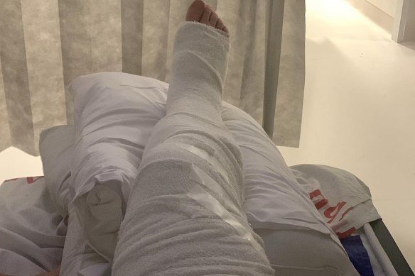 North Melbourne legend Brent Harvey posted this image on Instagram after having surgery on Sunday morning. Harvey suffered a broken right leg playing in a local football match then endured a long wait for an ambulance. 