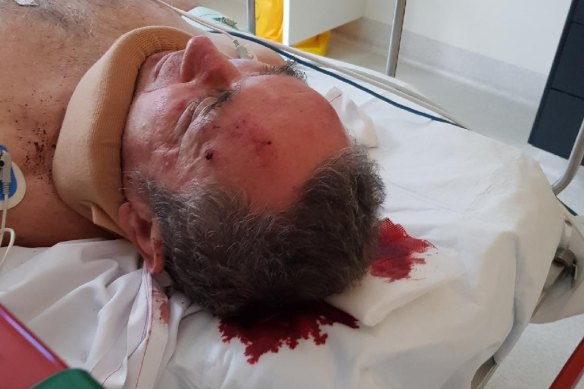 Jim Dodrill in the PA Hospital Emergency Room after the attack in June 2017.
