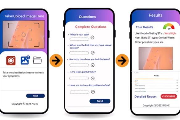 The Australian-developed AI model is able to fairly accurately distinguish between STIs from a patient image. 