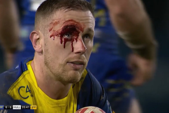 Warrington’s Ben Currie after the collision.