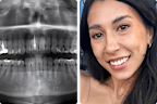 Emily Novo’s dental pain turned into an emergency hospital visit.