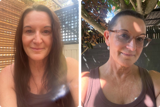 Cassandra Thorburn before and after cutting her hair after cancer diagnosis.