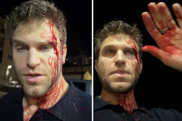 Actor Keegan Allen robbed in Hollywood