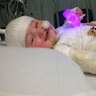 Charlie Burgess was only 11 months old when he suffered burns after pulling a deep fryer off the kitchen bench.