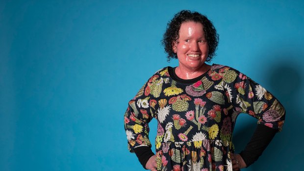 Disability advocate Carly Findlay is taking part in the panel Rethinking Beauty at the All About Women festival.