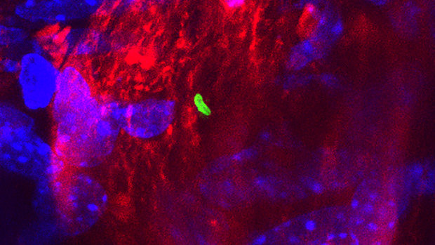 Bacteria (green) can use damage to the nasal cavities to travel up the olfactory nerve (red) to the brain, research has found.