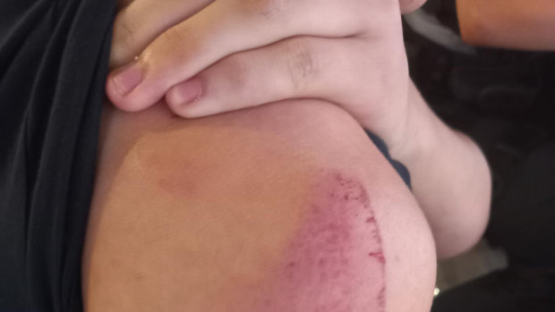 ‘They were going to leave him naked in Chadstone’: Teen boy bashed, robbed at shopping centre
