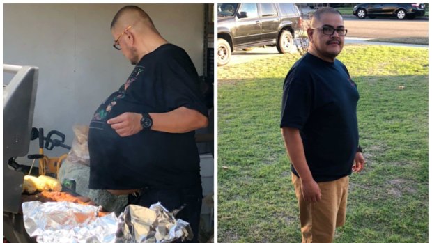 Hector Hernandez before surgery, left, and after surgery, during which doctors removed a 34-kilogram tumour from his abdomen. 