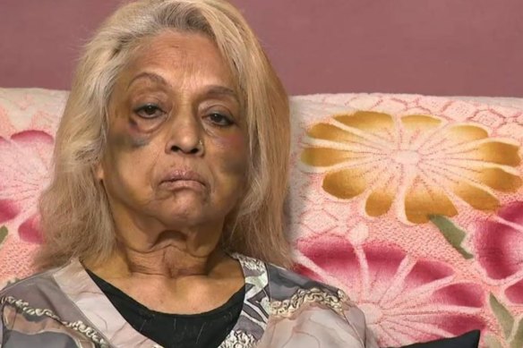 Home invasion victim Ninette Simons says: “I handed over all of my life’s savings on a platter, only to be bashed for it.”