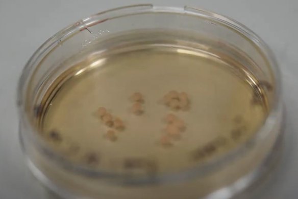 Brain organoids [3D miniature versions of organs] created by scientists at the University of Queensland’s Australian Institute for Bioengineering and Nanotechnology.