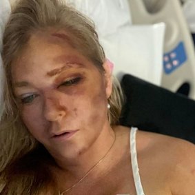 Guiffre posted this image to her Instagram claiming she was suffering from kidney failure and had just days to live.