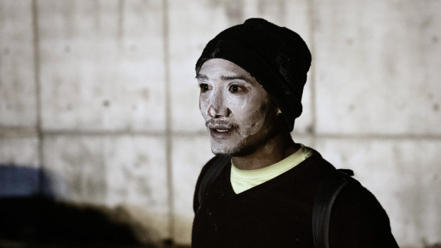 A migrant with his face covered in white after receiving a treatment against tear gas.