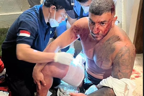 Sanar Ghanim dopo essere stato colpito da un proiettile a Bali. È sopravvissuto alle ferite.