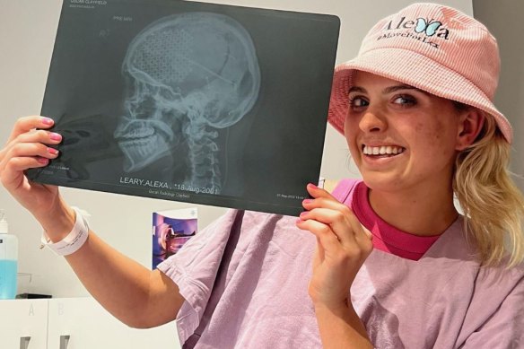 Alexa Leary has made a remarkable recovery from a serious brain injury. 