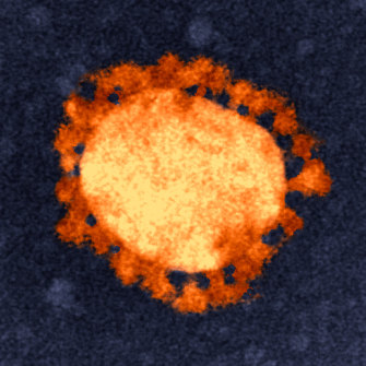  An electron-microscope image of the COVID-19 virus.