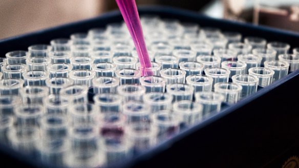 Newly published results from Proteomics International have revealed its PromarkerEso blood test can detect early oesophageal cancer with 91 per cent accuracy.