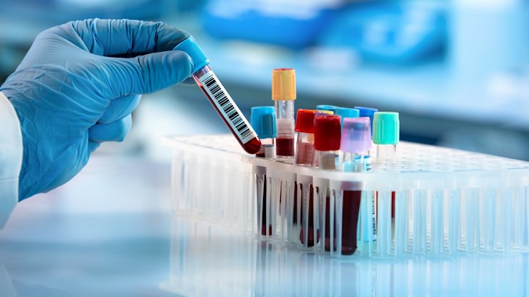 smh.com.au - Murray Ward - Proteomics bags US patent for endometriosis test