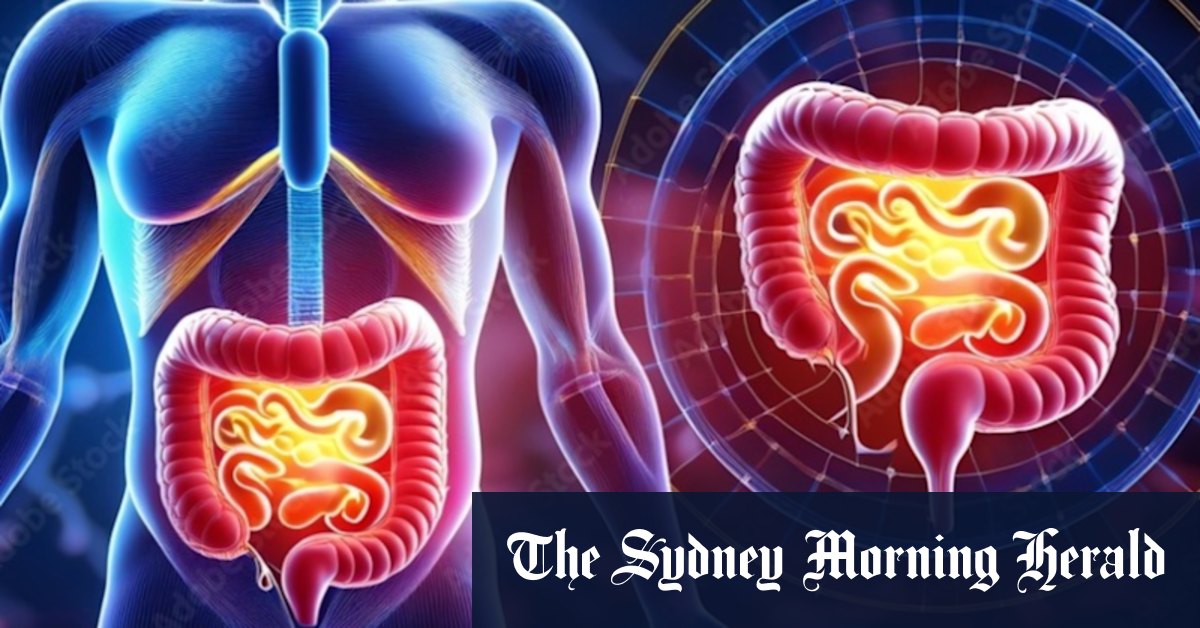 TGA backs NeuroScientific stem cell assault on Crohn’s disease