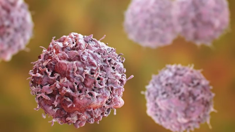 Amplia uncovers new clue in pancreatic cancer drug trial
