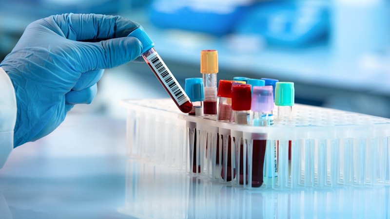 Proteomics bags US patent for endometriosis test