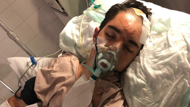 18-year-old Lawson Rankin is in critical condition in a Bali hospital after falling from a scooter. 
