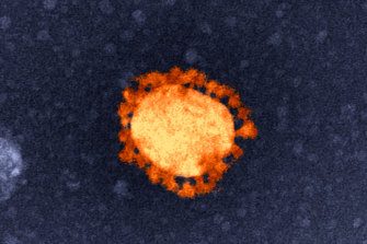 The virus responsible for COVID-19, isolated from the first Australian coronavirus case.