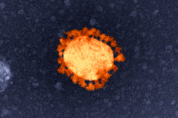 An electron-microscope image of the COVID-19 virus.