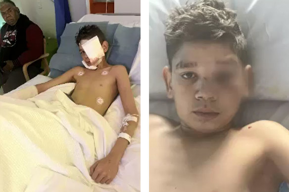 Jayden, 13, was mauled by a WA Police dog on Sunday night as officers responded to reports of incidents in St James. 