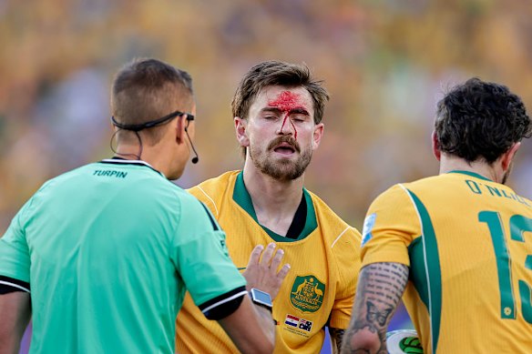 Connor Metcalfe is injured, halting play. 