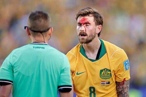 And another angle. Ouch.