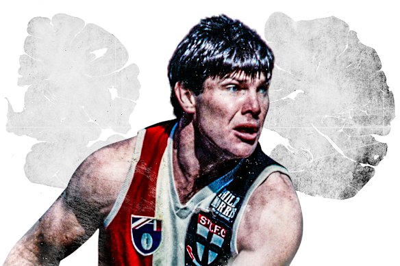 Danny Frawley was diagnosed posthumously with CTE.