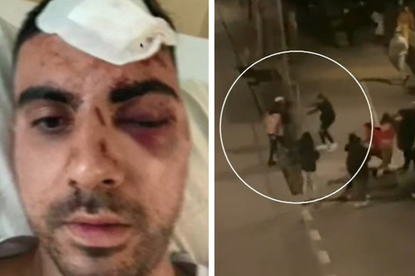 The man was bashed outside the MCG after the Dreamtime at the ’G game.