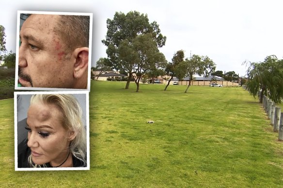 Craig and Shelly Edwards were bashed by a group of teenagers at this Clarkson park earlier this year. 